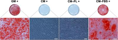 Brief communication: Effects of conditioned media from human platelet lysate cultured MSC on osteogenic cell differentiation in vitro